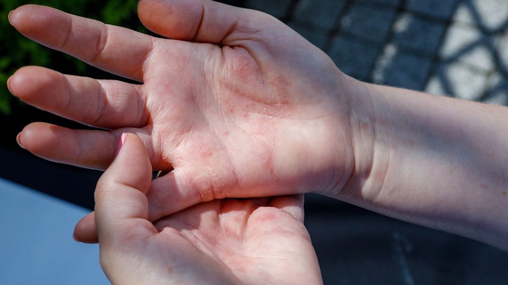 Jakie objawy daje chora tarczyca?