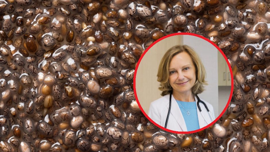 Dr Elizabeth Klodas zaleca wprowadzenie zmian w diecie