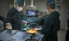 Historyczne osiągnięcie. Przeszczepili człowiekowi wątrobę świni