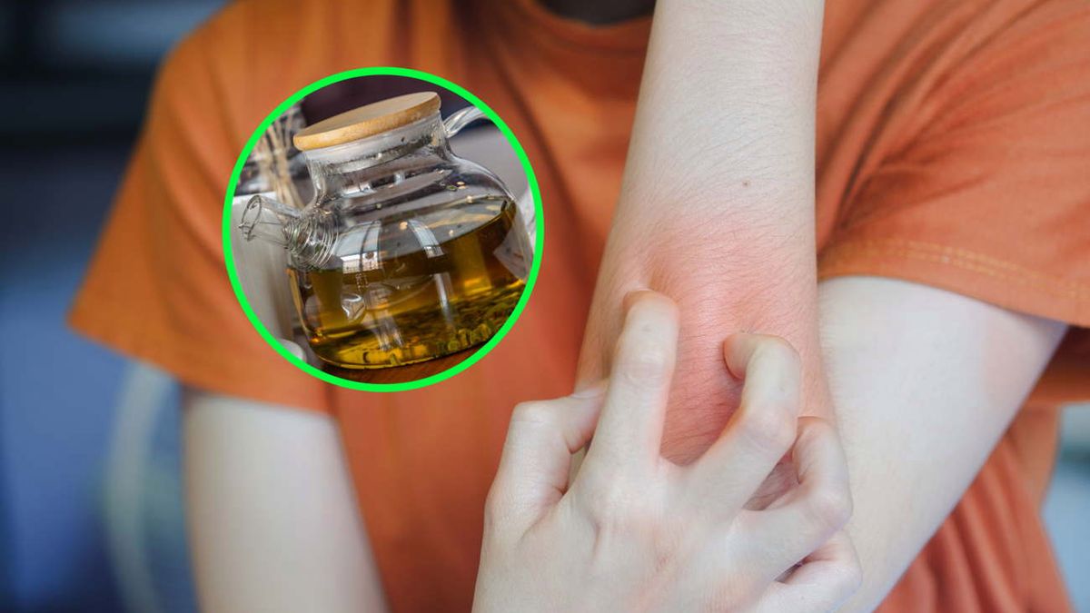 Nie przyniosą ochłody. Picie tych napojów może skończyć się wysypką albo oparzeniem