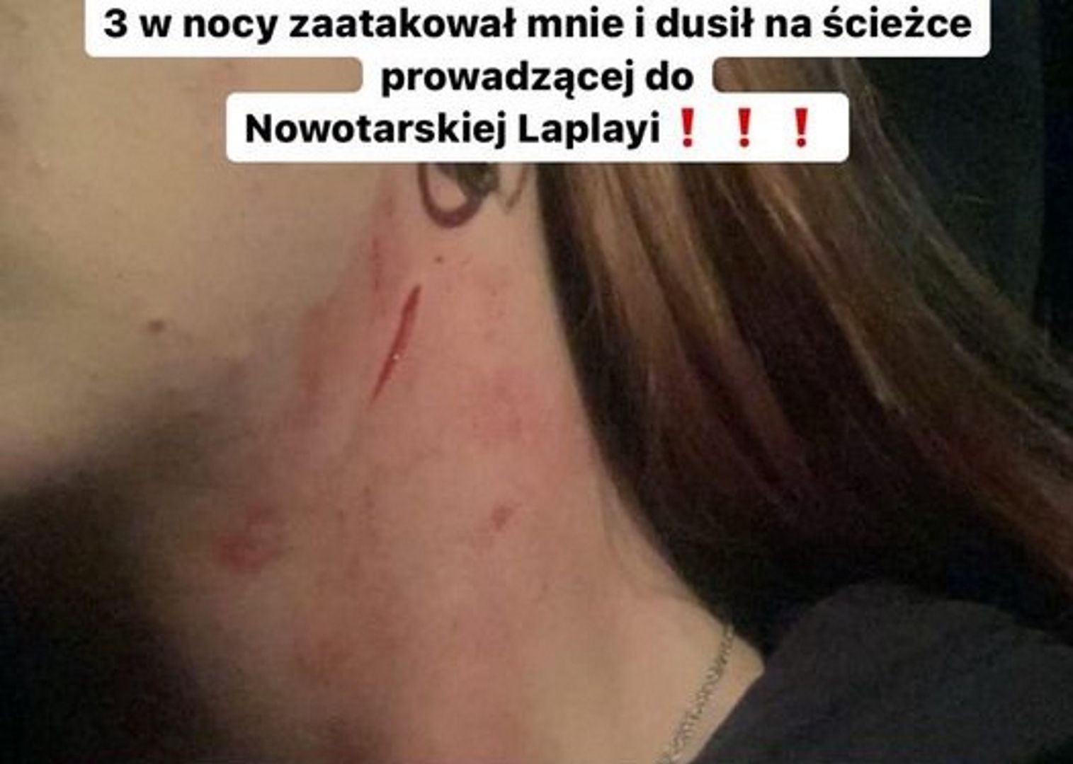 Brutalny atak na Podhalu. "Rzucił w krzaki i zaczął dusić"