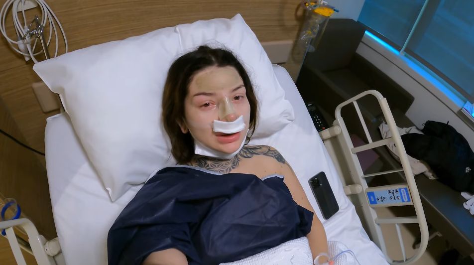 Marcysia Ryskala zrobiła operację nosa