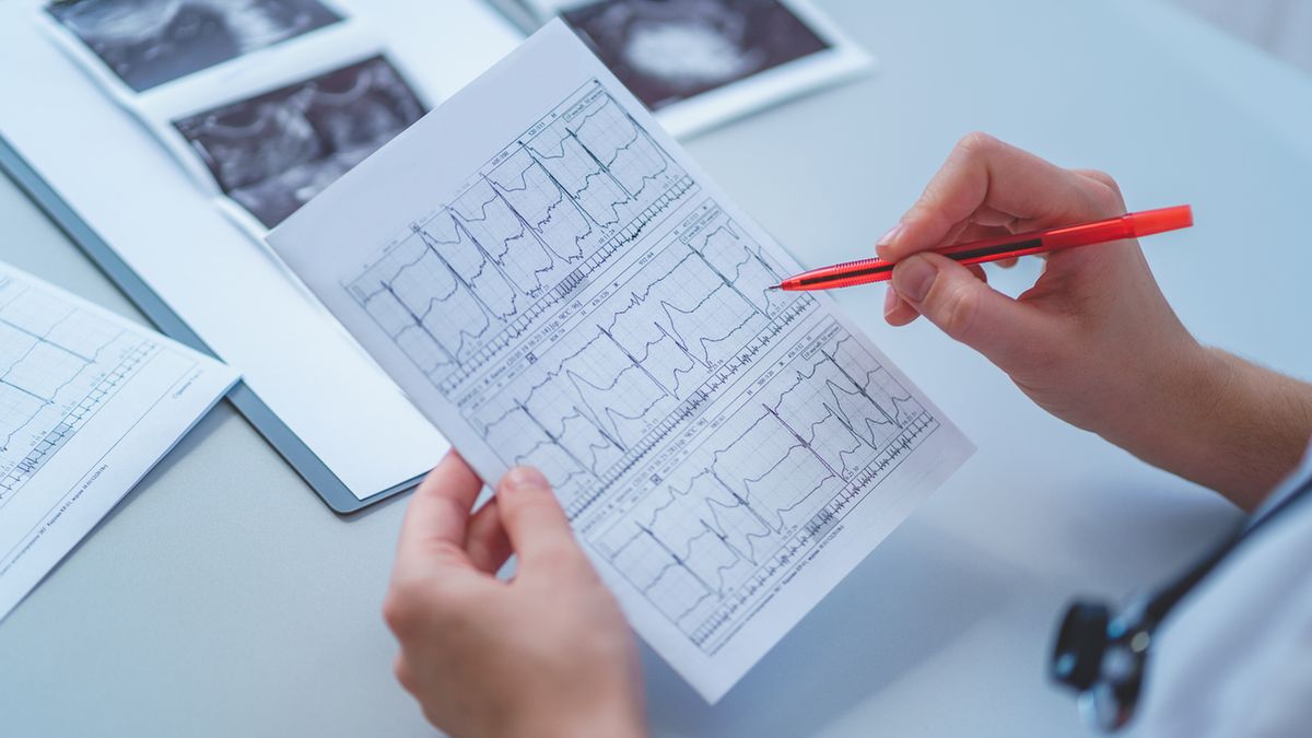 Zaburzenia przewodzenia śródkomorowego są widoczne w zapisie badania EKG.
