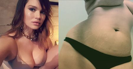Modelka XXL z okładki "Vogue’a" pokazała rozstępy (ZDJĘCIA)