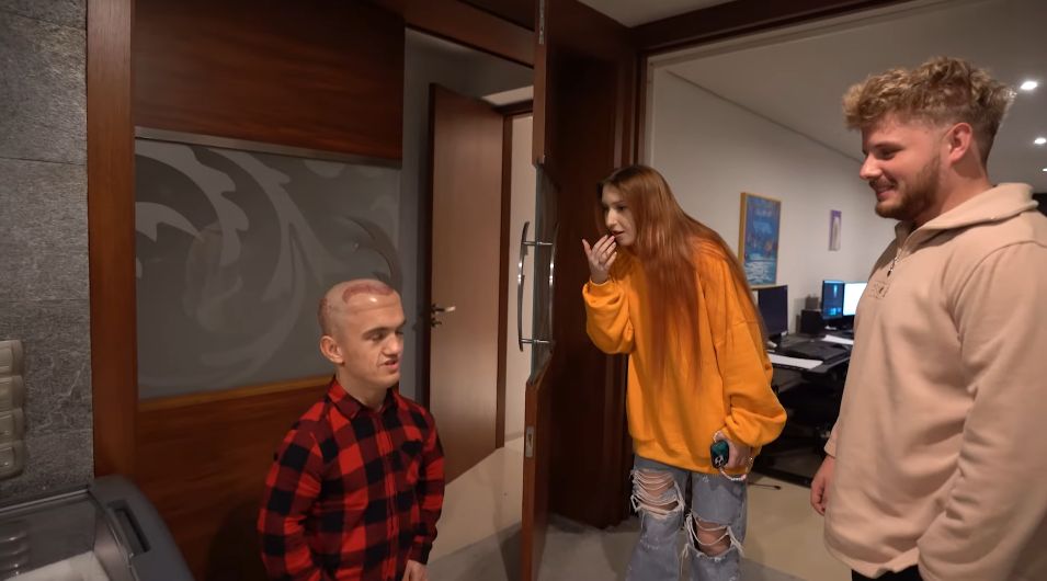 Mini Majk przeszczepił sobie włosy