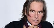Musiał zrezygnować z roli w serialu. Val Kilmer przez lata walczył z nowotworem