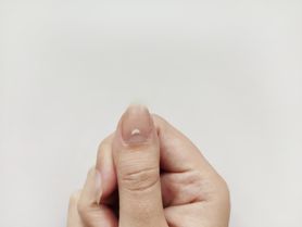 Białe plamki na paznokciach. O czym mogą świadczyć?