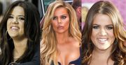 Khloe Kardashian: "Nie miałam żadnych operacji plastycznych!"