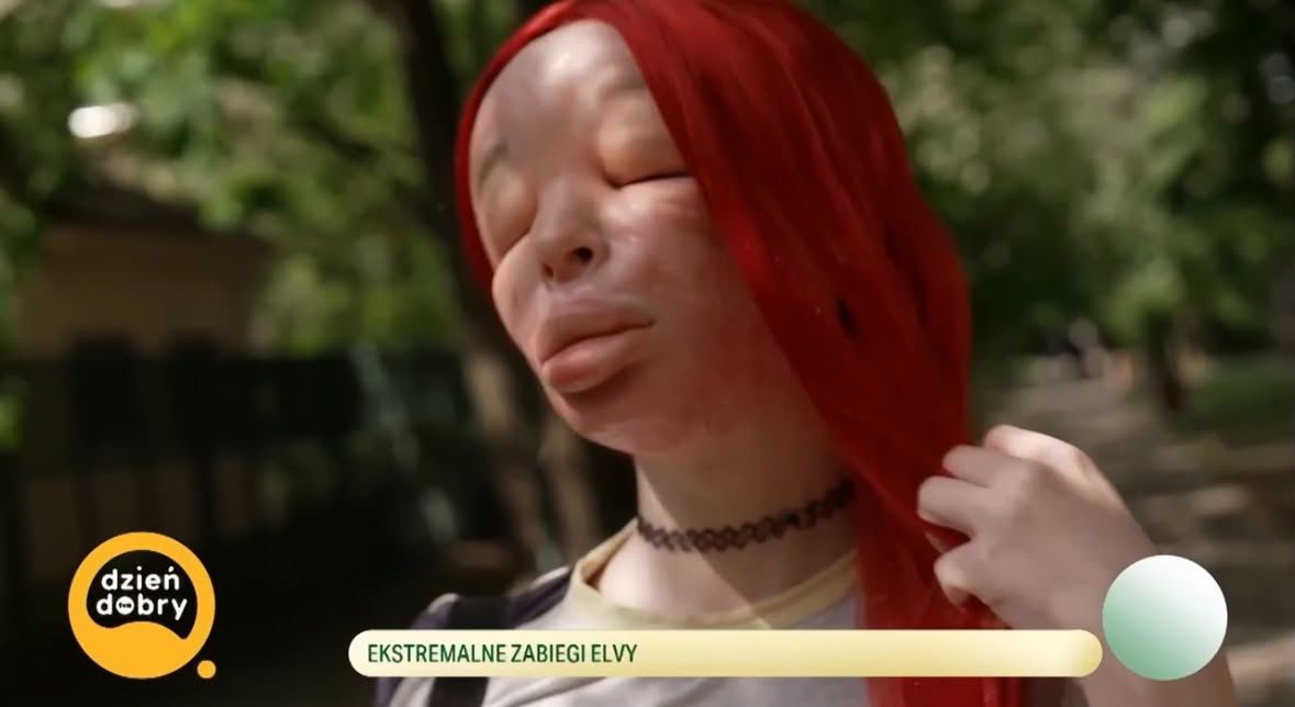 26-letnia Elva zdeformowała sobie twarz