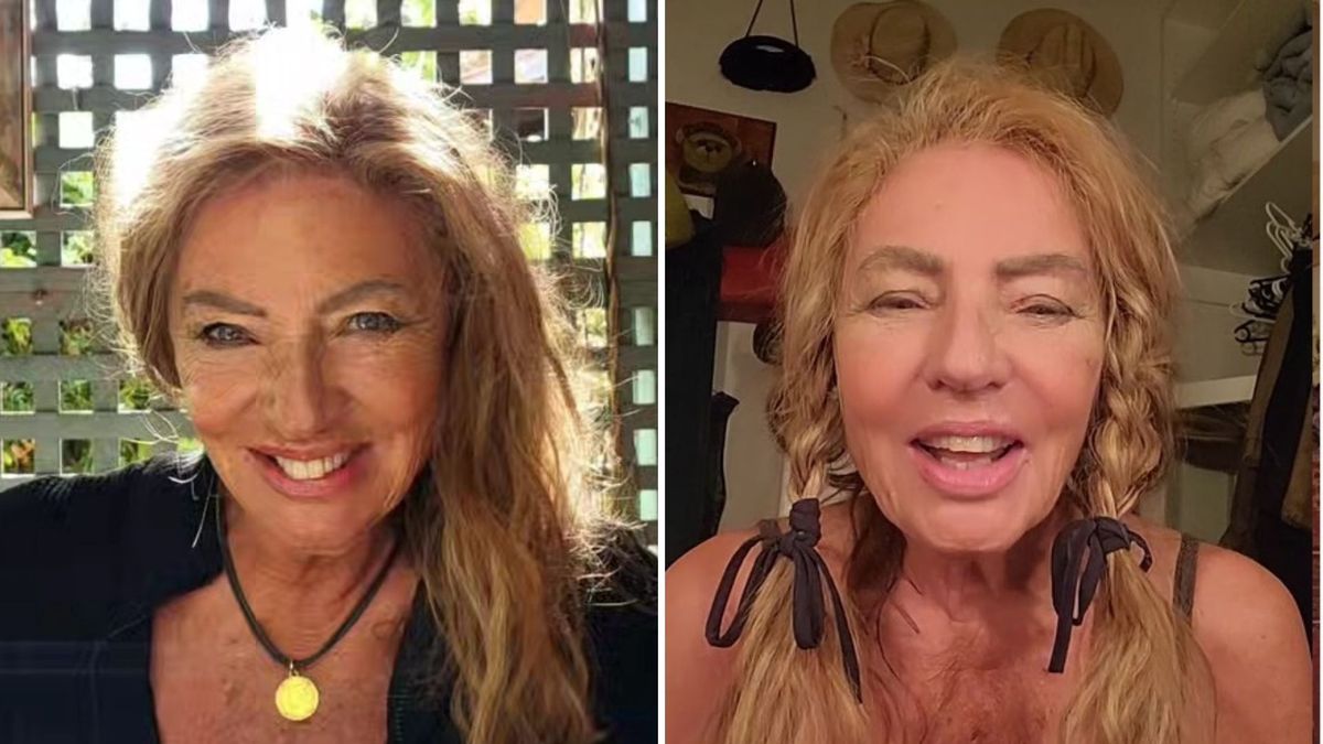 Agnieszka Fitkau-Perepeczko o swoim stanie zdrowia