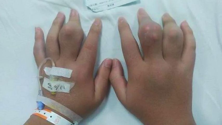 Nastolatek nadużywający bubble tea trafił do szpitala