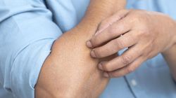 Wczesne objawy raka trzustki. Występują u 75 proc. pacjentów