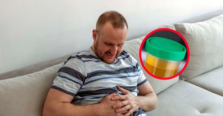 Zwróć uwagę na kolor moczu. Sygnał, że rak panoszy się w ciele