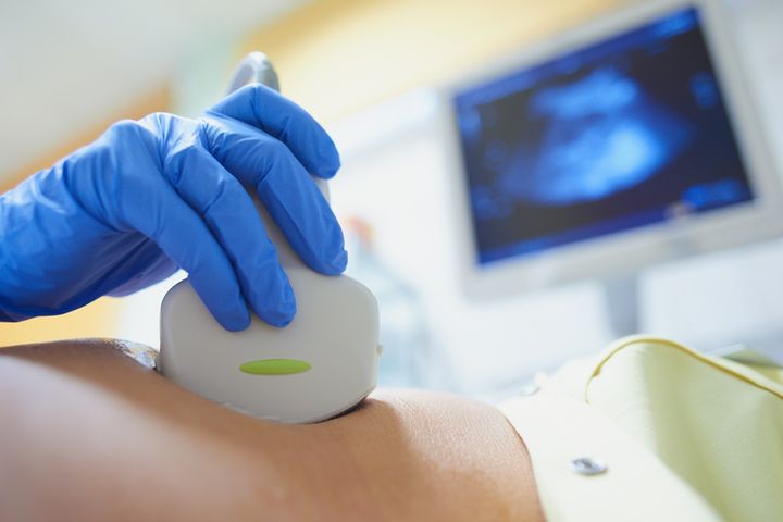 Obecność krwiaka podkosmówkowego można stwierdzić jedynie poprzez badanie ultrasonograficzne