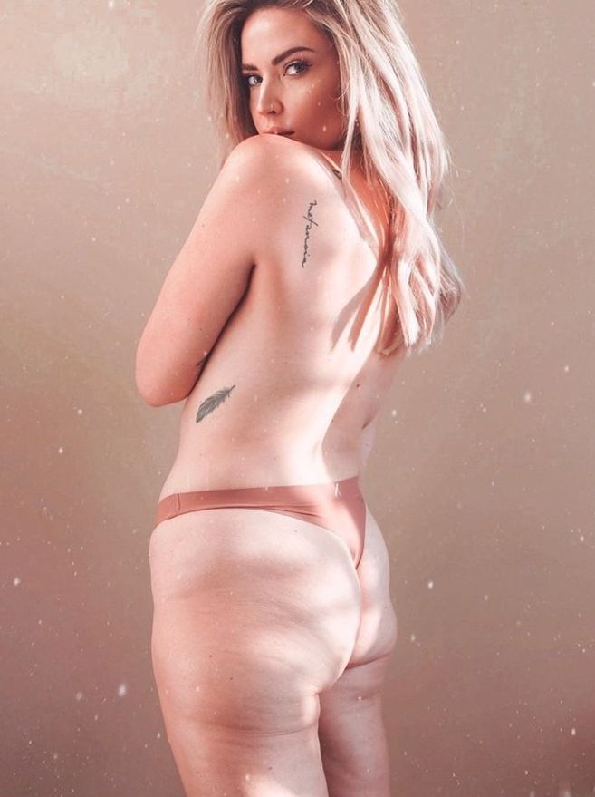 Cellulit i rozstępy zostały po ciąży 