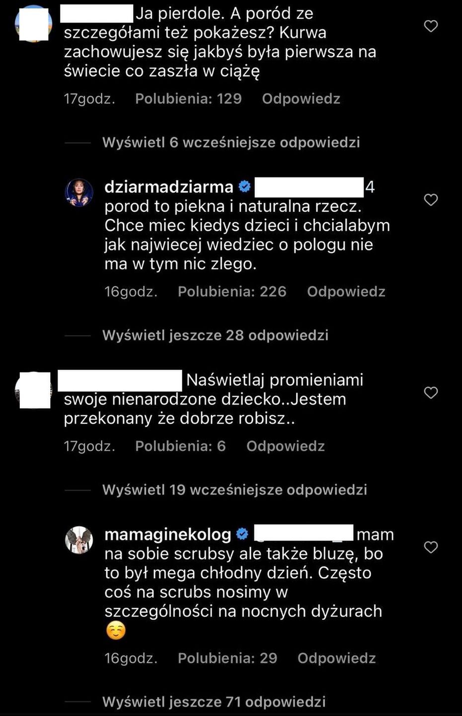 Lil Masti relacjonuje badanie USG u Mamy Ginekolog