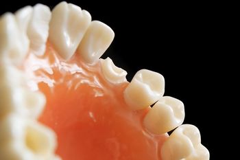 Polscy dentyści coraz popularniejszym wyborem Czechów. Tak na tym korzystają