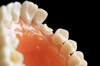 Polscy dentyści coraz popularniejszym wyborem Czechów. Tak na tym korzystają