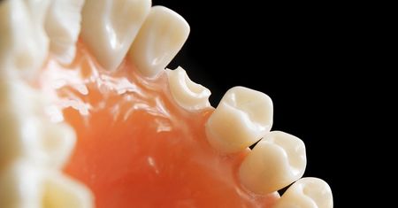 Polscy dentyści coraz popularniejszym wyborem Czechów. Tak na tym korzystają