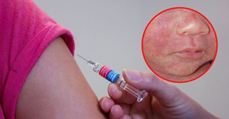 Wraca nasz stary wróg. Połowa świata zagrożona, możliwa epidemia