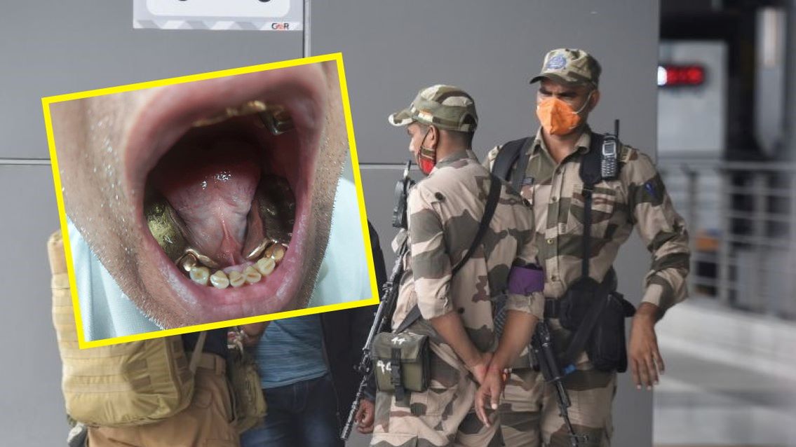 Przemytnik ukrył złoto w jamie ustnej 