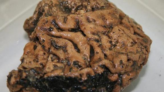 Mózg sprzed 2500 lat zbadany - wciąż nie wszystko wiadomo 1