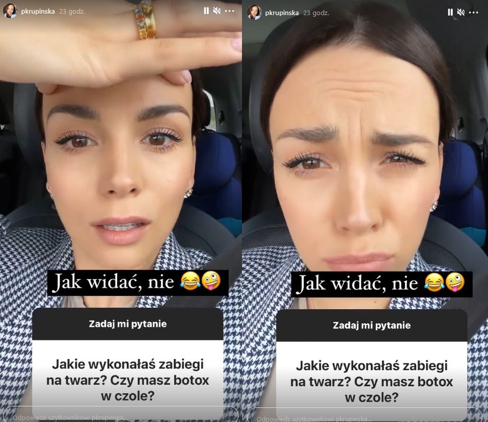 Paulina Krupińska przekonuje, że nie ma botoksu