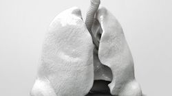 Popromienne zwłóknienie tkanki płucnej