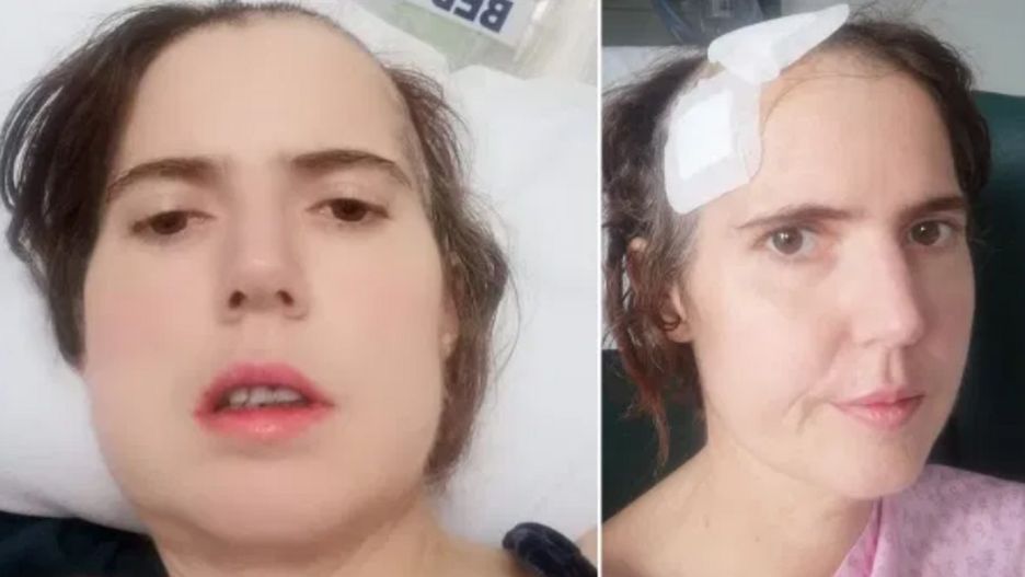 Kobieta zlekceważyła ból zęba