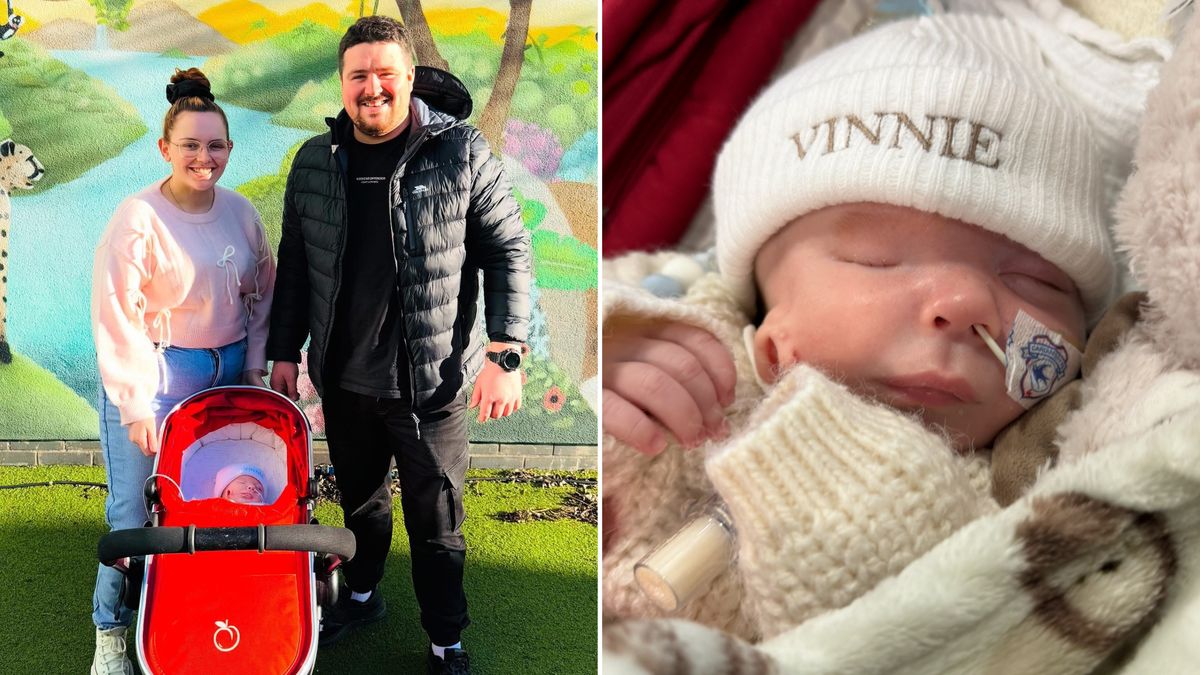 Vinnie urodził się z poważną wadą.