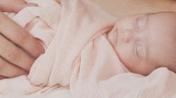 Dolichocefalia - charakterystyka, przyczyny i leczenie