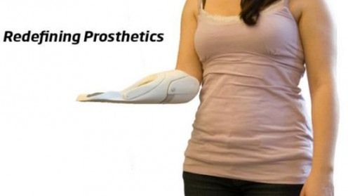 Nietypowa proteza ręki 1