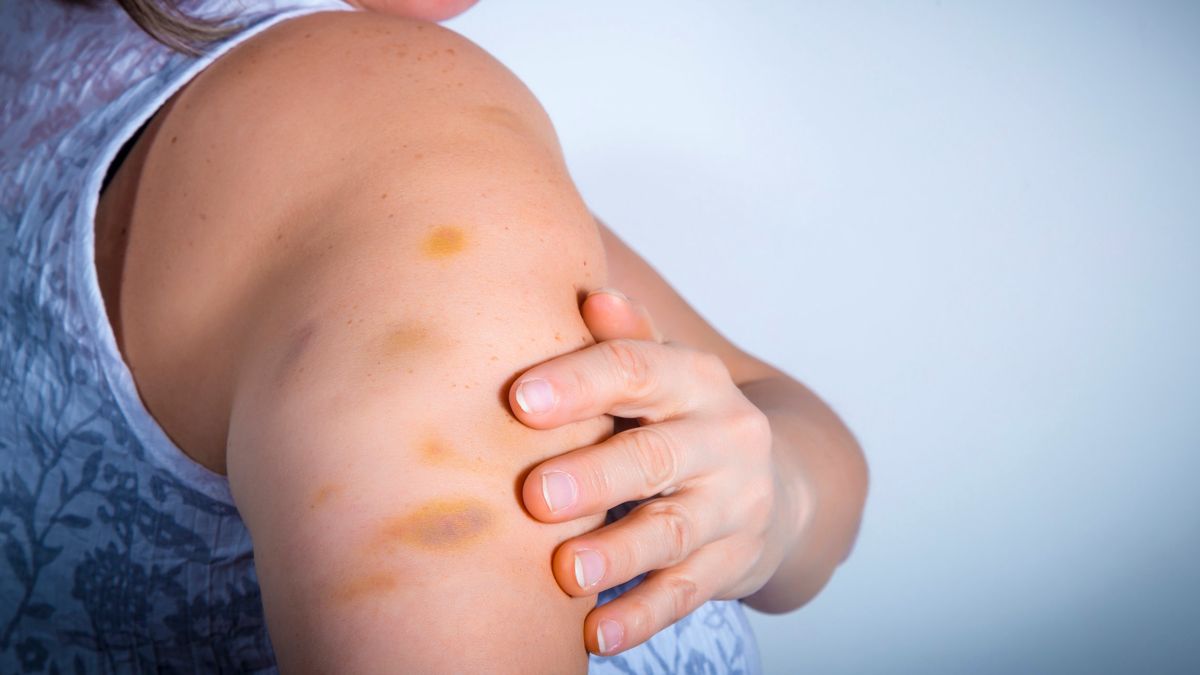 Siniaki mogą być objawem