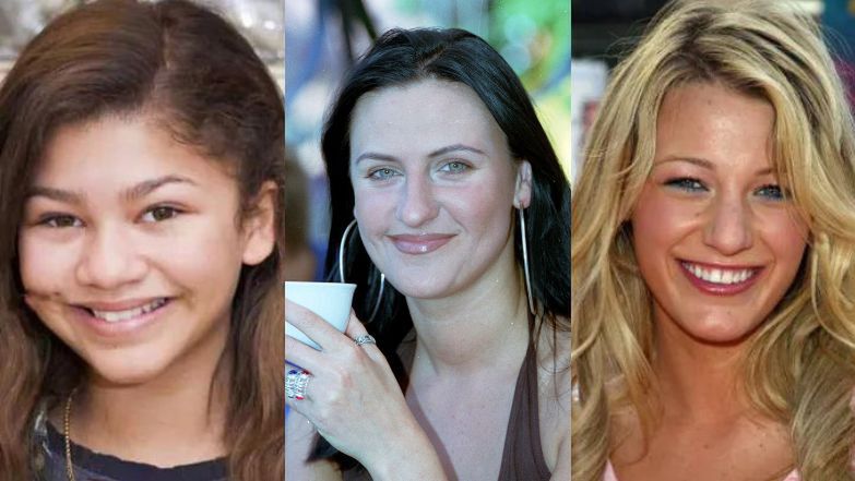 Te gwiazdy zdecydowały się na korektę nosa 