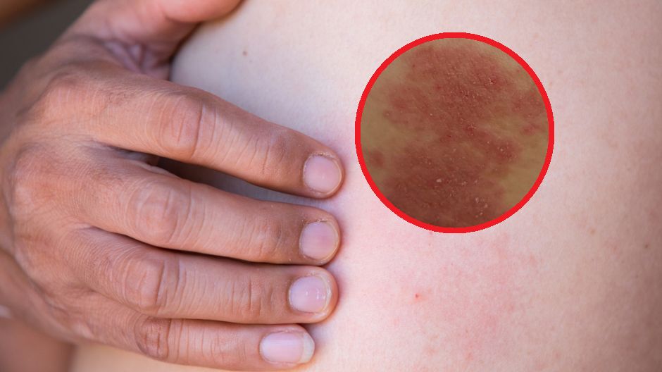 Tak dużo zachorowań nie było od 9 lat