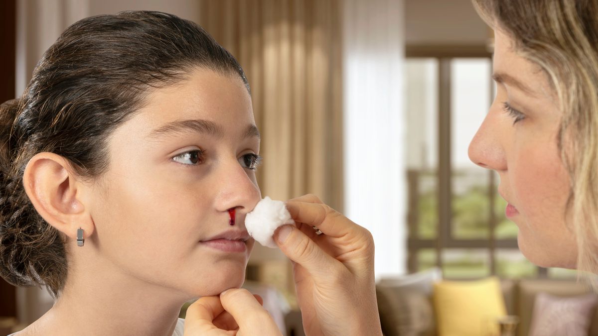 Krwawienie z nosa może wynikać z przyczyn miejscowych, ale też jego przyczyną mogą być choroby ogólnoustrojowe.