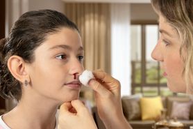 Krwawienie z nosa - dlaczego nos krwawi? Przyczyny krwawienia z nosa