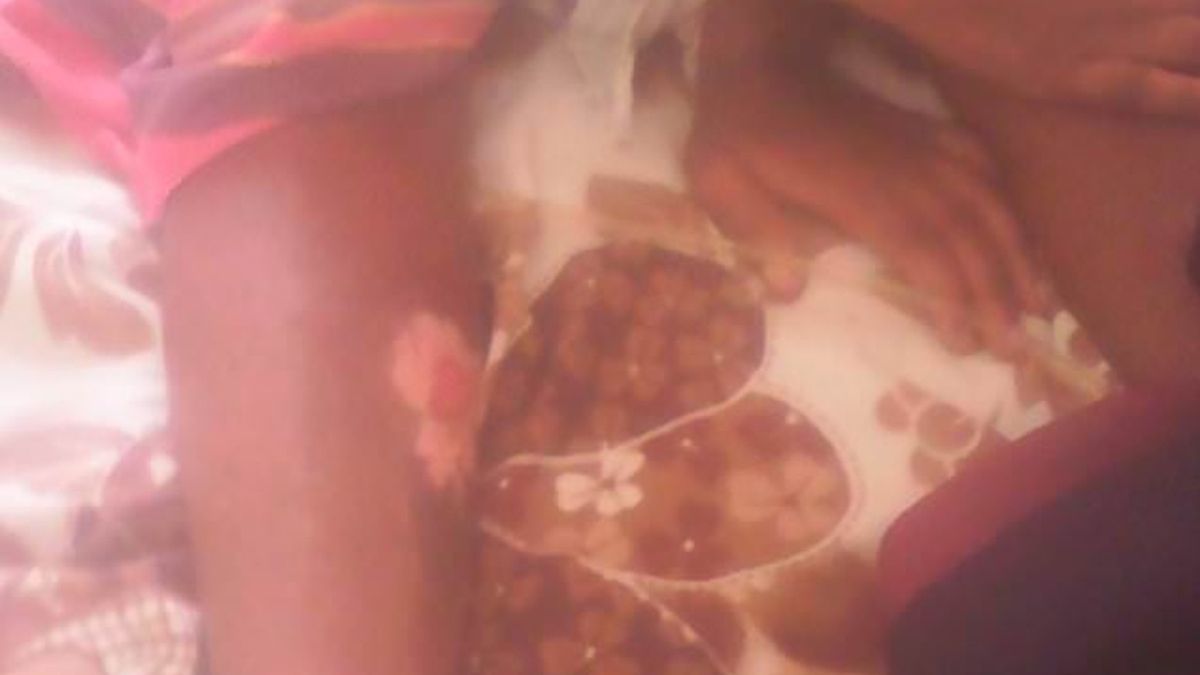 Rahema Kyomuhendo ma liczne rany na ciele. Podpalenia dokonał jej ojciec