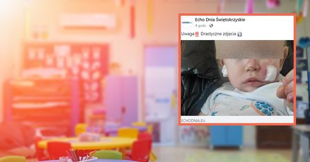 Zmasakrowany roczniak potrzebował trzech szwów. Sprawę bada prokuratura