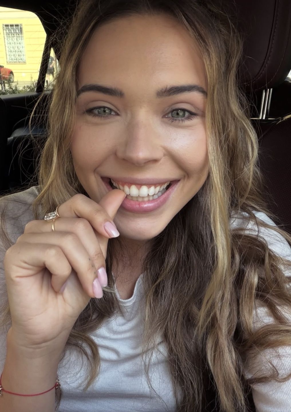 Sandra Kubicka pokazała się 20 dni po operacji 