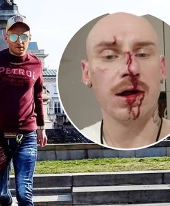 Jacek Szawioła pobity. Uczestnik "Gogglebox" wydał oświadczenie