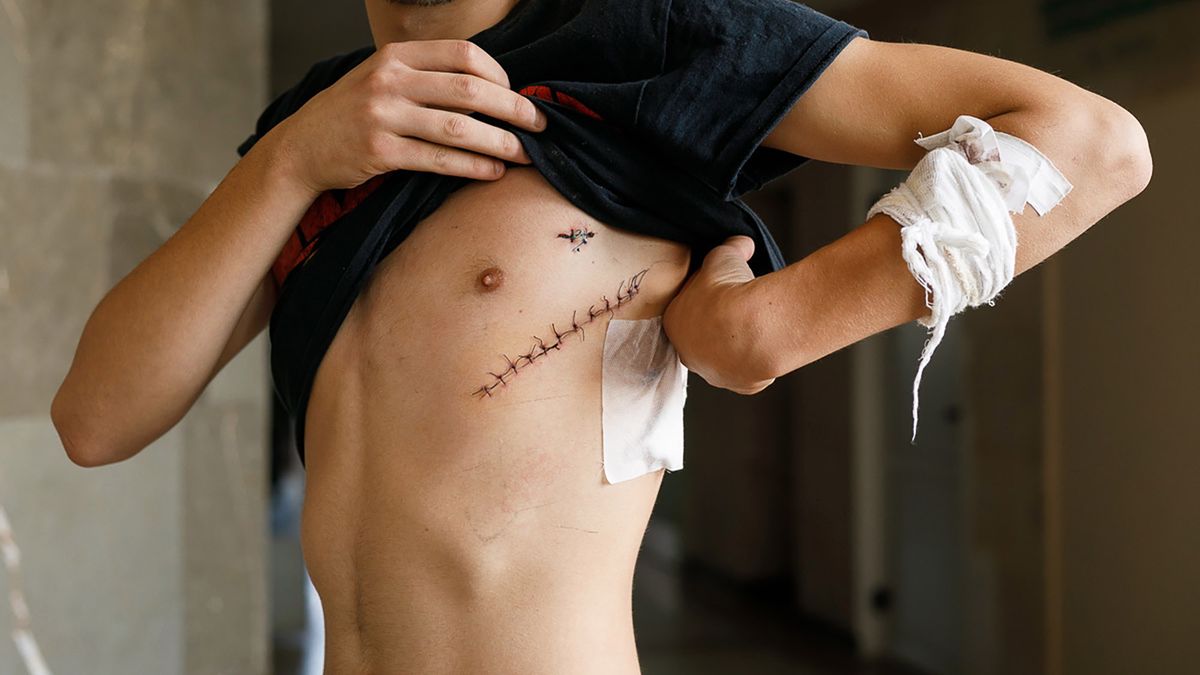 Z jego płuc wyjęto kulę. To zdjęcie pokazuje, jak traktowani są cywile na Białorusi 1