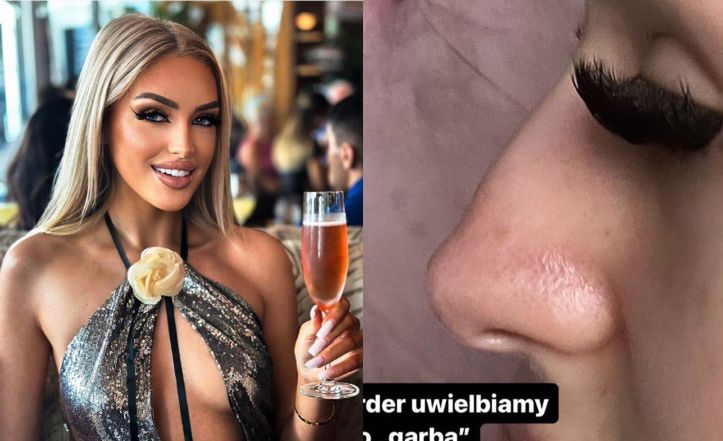 Fanka do Caroline Derpienski: "Masz GARBKA na nosie"
