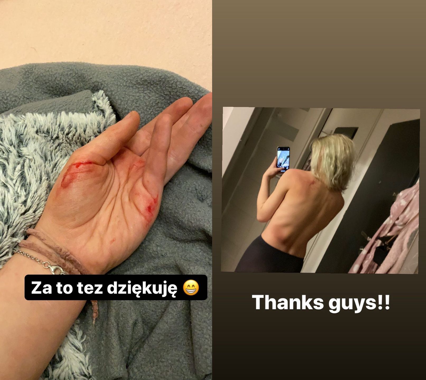 Poranione ciało Julii Wróblewskiej po protestach.