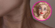 Szał na "Barbie botox". Lekarze biją na alarm