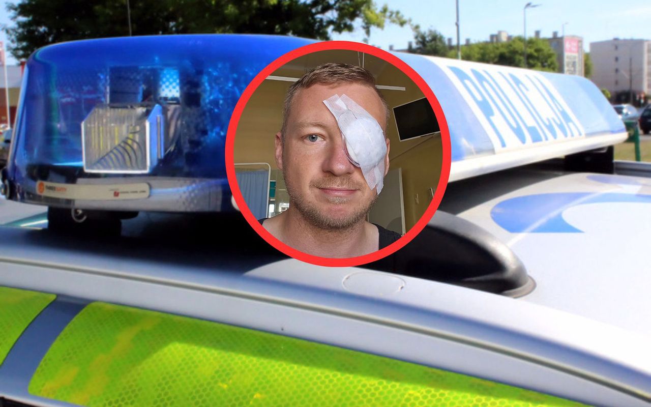 Dziennikarz o2.pl postrzelony w Toruniu. "Dokonano przeszukań lokali"