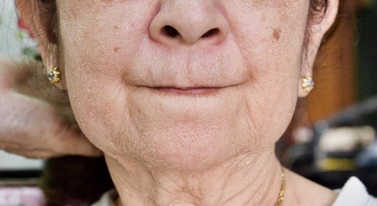 Wymieszaj dwa składniki. Domowa maseczka wygładzi zmarszczki