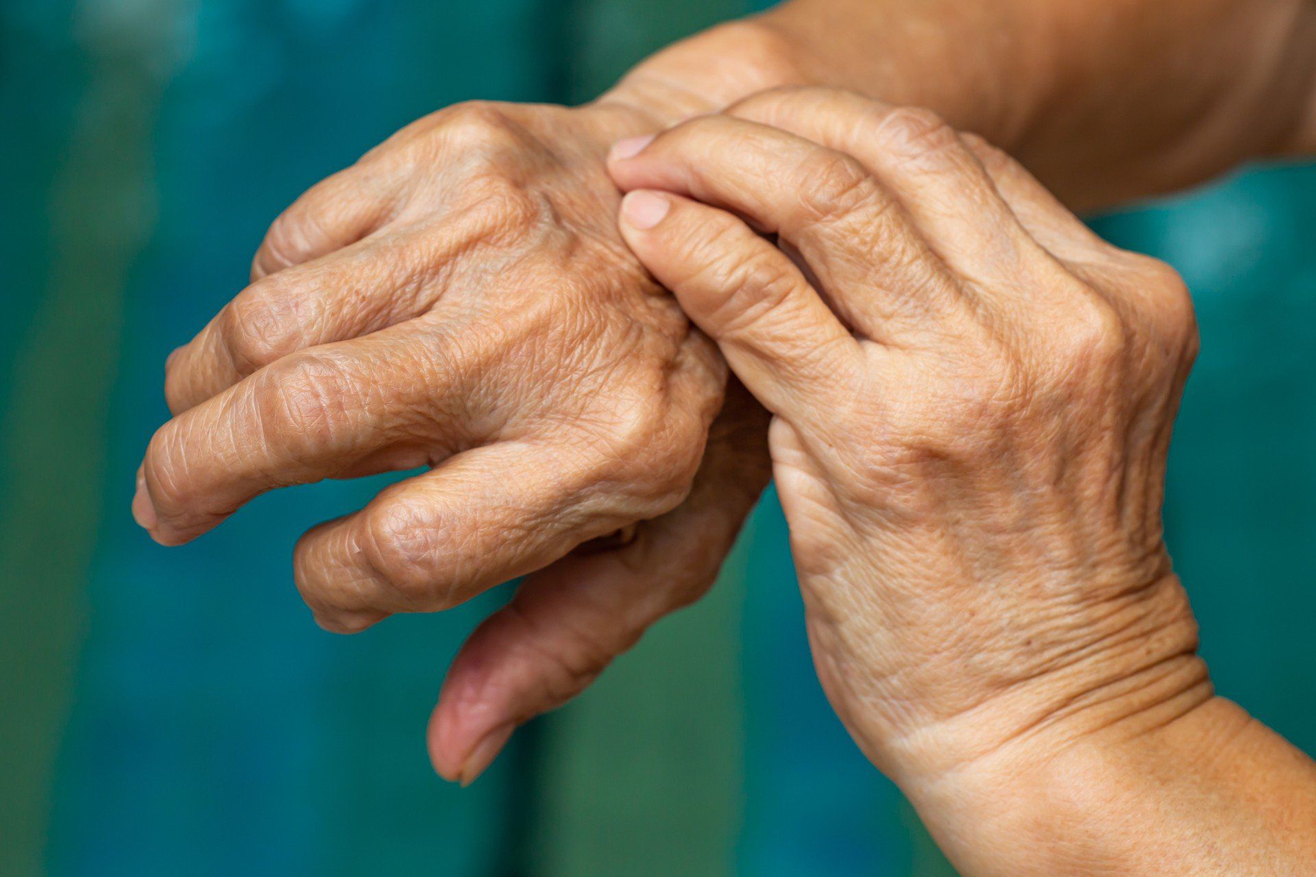 Senior Woman&#39;s left hand scratching her right hand, Blue swimming pool background, Close up shot, Asian Body skin part, Healthcare concept