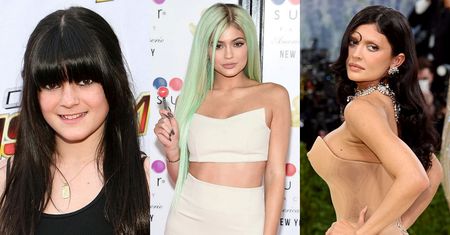 Od "brzydkiego kaczątka" do ociekającej seksapilem milionerki. Tak OPERACJE PLASTYCZNE zmieniły Kylie Jenner (ZDJĘCIA)