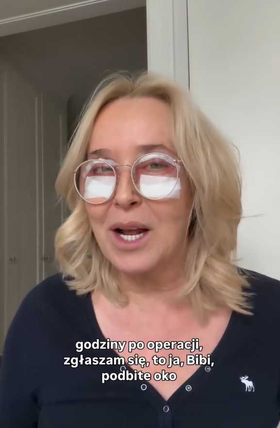 Agata Młynarska zrobiła operację powiek